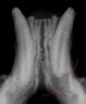 Digital X-Rays
