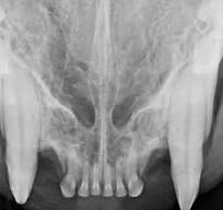 Digital Radiograph
