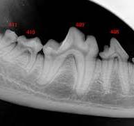 Dental Radiograph