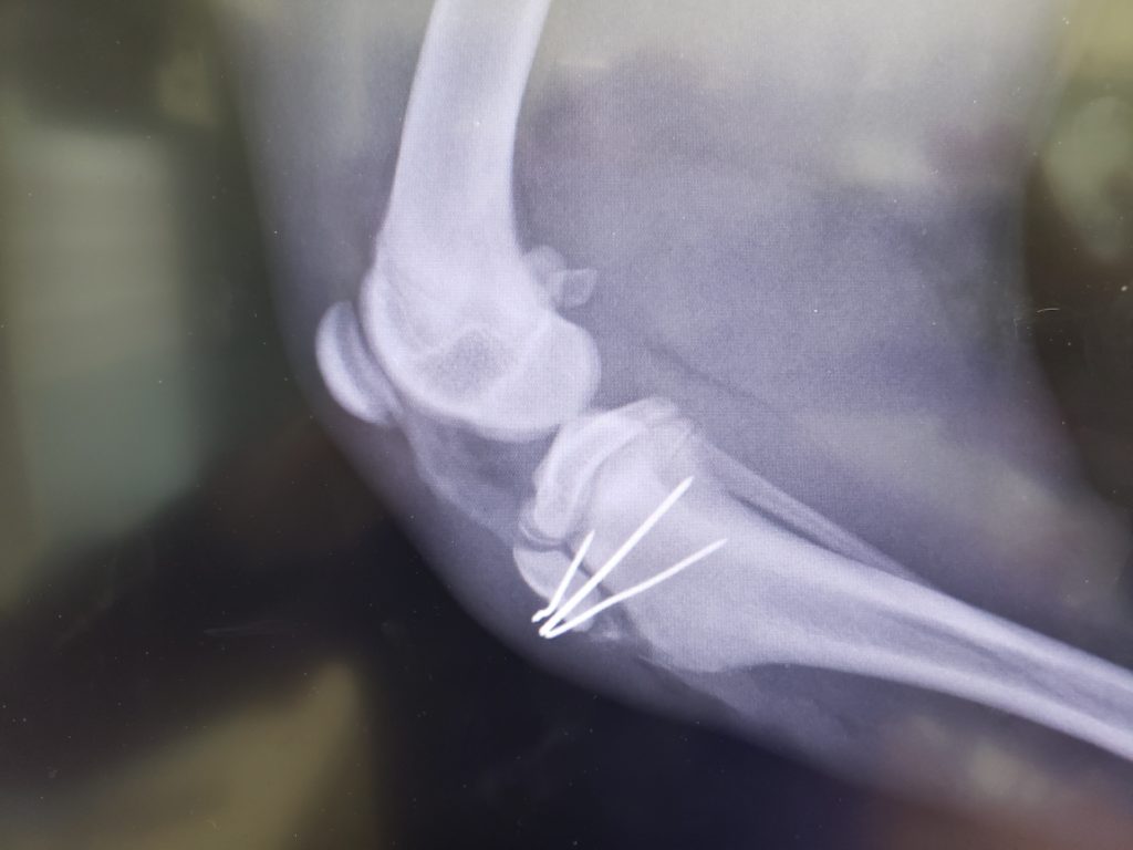 X-Ray